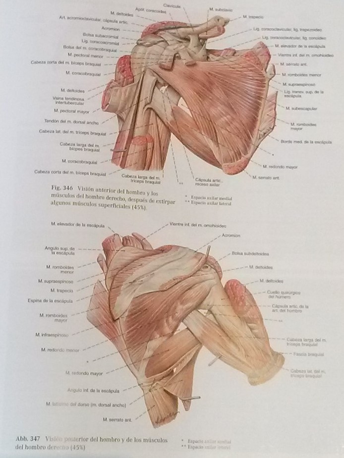 Tendinitis del supraespinoso.